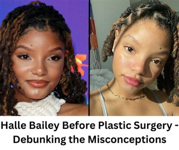 Did Halle Bailey Undergo Plastic Surgery Including Boob Job, Nose Job
