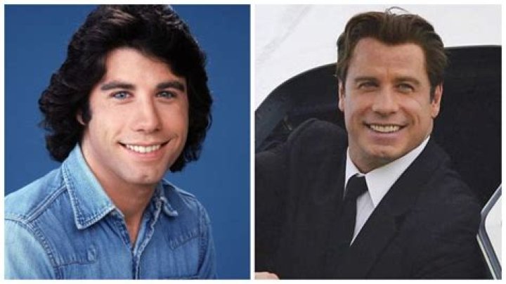 Did John Travolta Get Plastic Surgery? To Maintain His Youthful