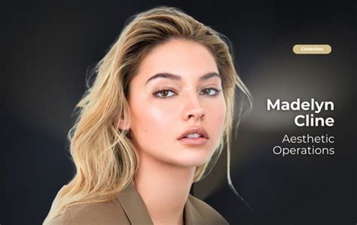 Did Madelyn Cline Get Plastic Surgery? The Young Actress Looks Way Too