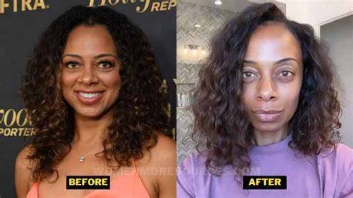 Did Nischelle Turner Undergo Plastic Surgery Including Boob Job, Nose