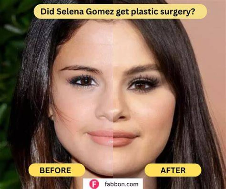 Did Selena Gomez Get Plastic Surgery? Inside Rumors Life & Style
