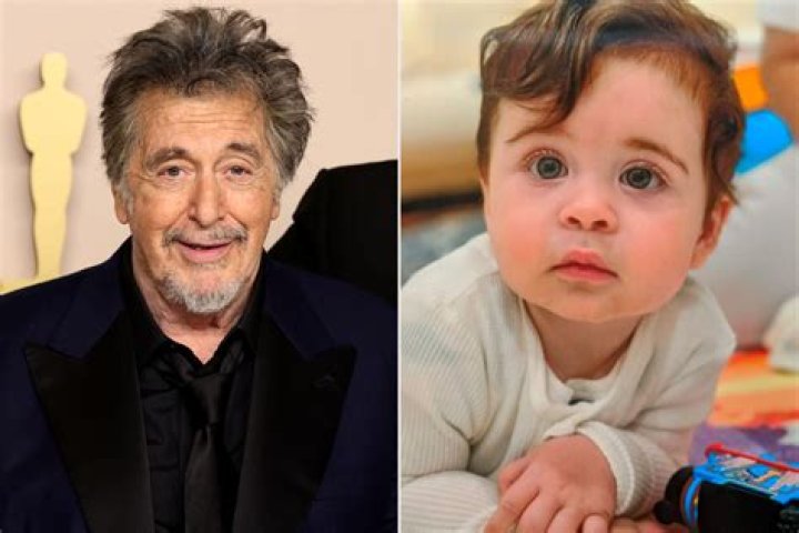 Does Al Pacinos son have any disability?