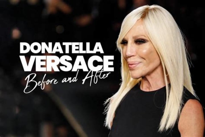 donatella versace a before and after Celebrity plastic surgery