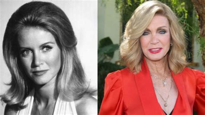 Donna Mills&rsquo; Plastic Surgery Before and After Changes Examined!