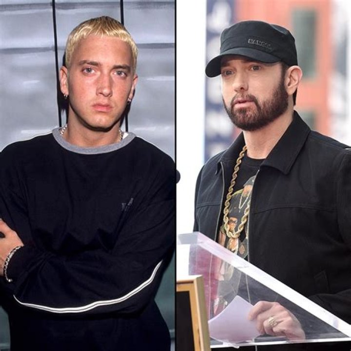 Eminem's Plastic Surgery Journey Explored