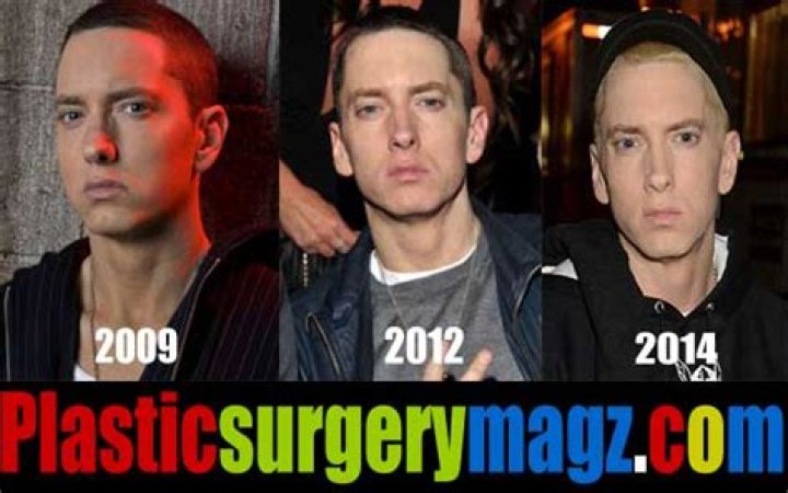 Eminem Plastic Surgery Changed His Face Completely
