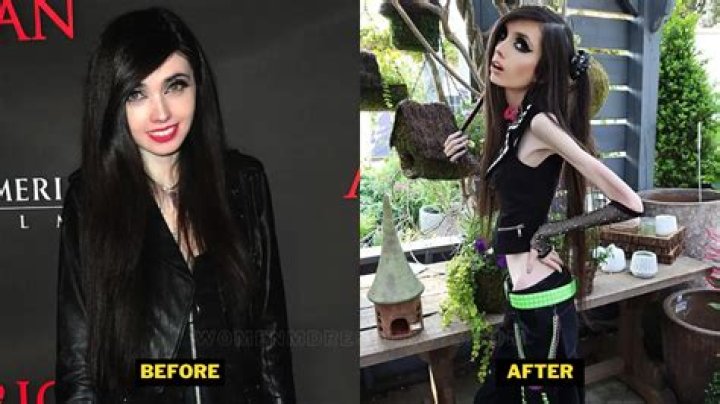 Eugenia Cooney Before And After How Did She Loss Her Weight? Lake