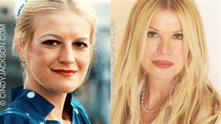 EXCLUSIVE Plastic Surgery Record Holder Has Advice for Heidi Montag