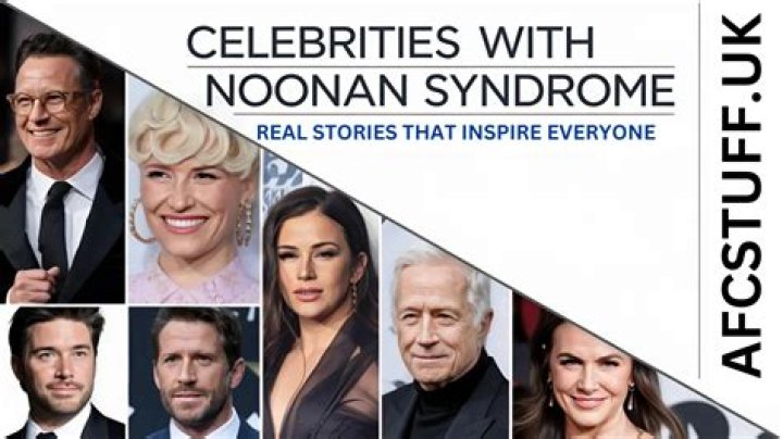 Famous Faces Celebrities with Noonan Syndrome