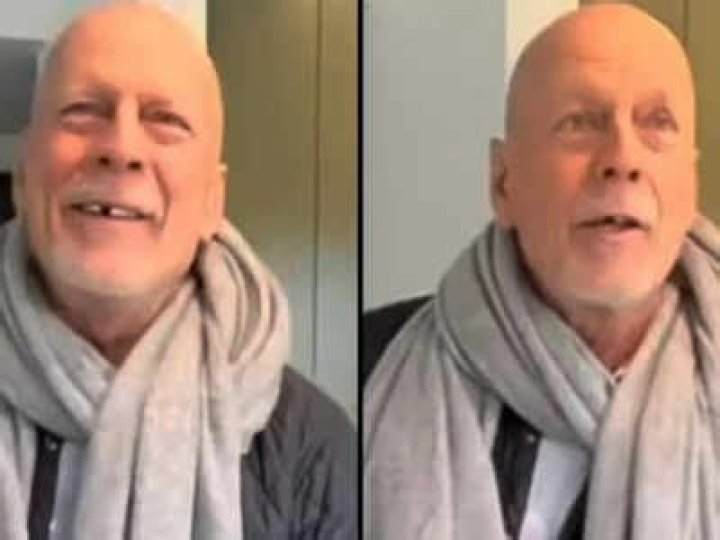 Fans are worried about Bruce Willis' missing tooth in recent pictures