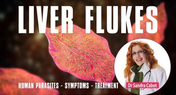 Flukes, intestinal and/or liver at Parasites Support Forum (Alt Med