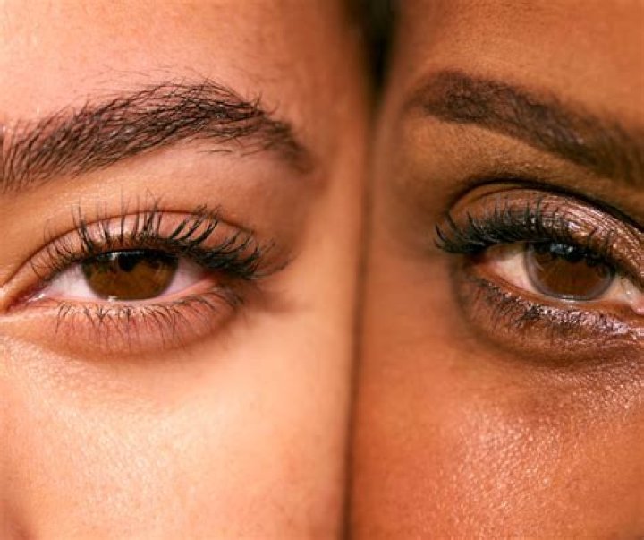 Forest Whitaker&rsquo;s Eye Explained by an Eyelid Surgeon Understanding