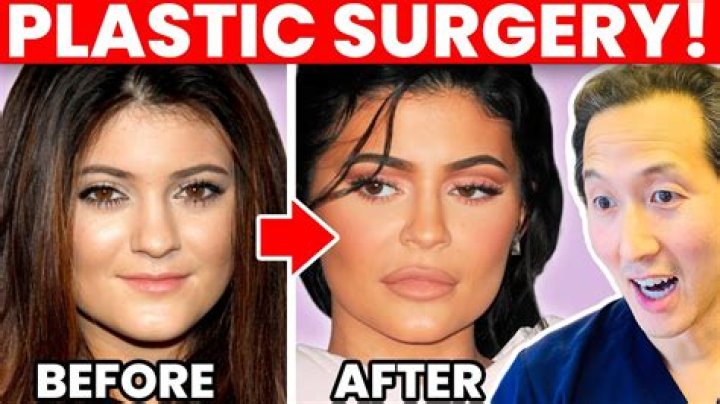 Get Insites To Her Plastic Sugery Situation.
