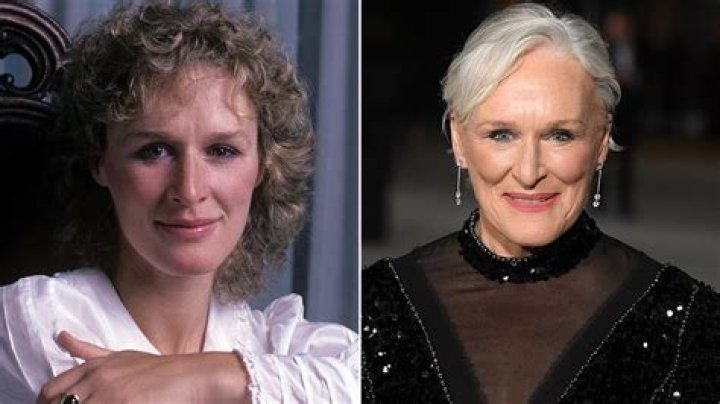 Glenn Close A life in pictures Photos ABC News