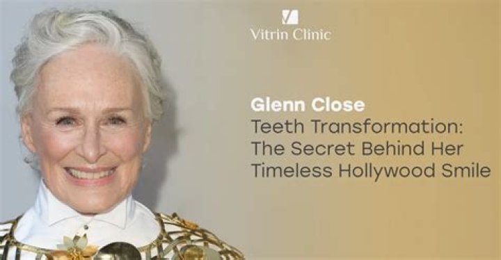 Glenn Close Glenn close, Famous actors and actresses, Celebrities female