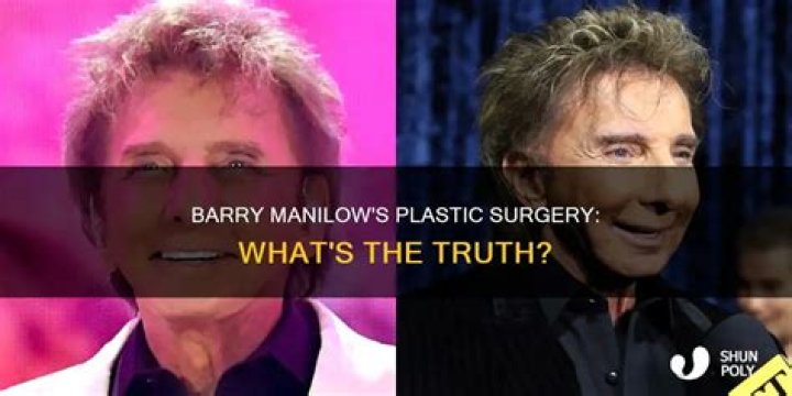 Has Barry Manilow Had Plastic Surgery? See the Singer's Transformation!
