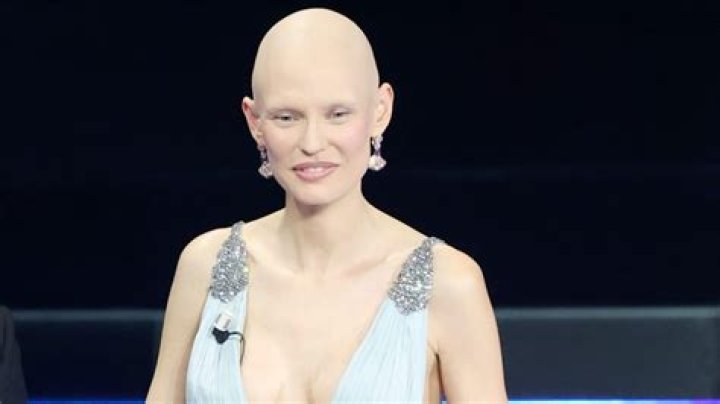 Has Bianca Balti Had Plastic Surgery? Body Measurements and More