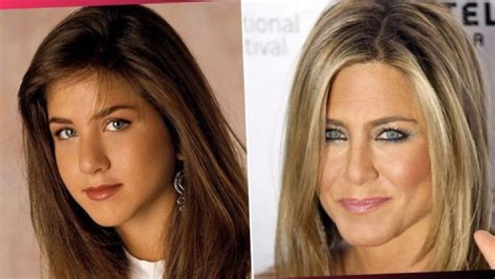 Has Jennifer Aniston Had Cosmetic Surgery?