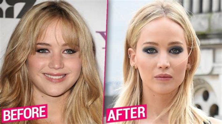 Has Jennifer Lawrence had Cosmetic Surgery? MYA Cosmetic Surgery