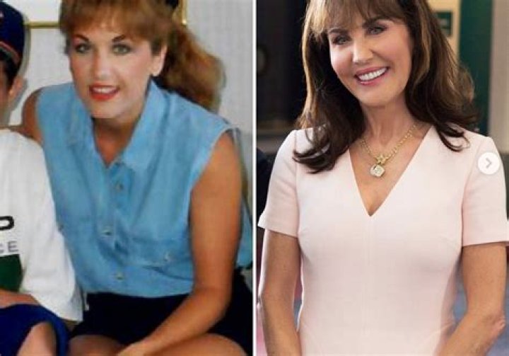 Has Robin McGraw Gotten Plastic Surgery?