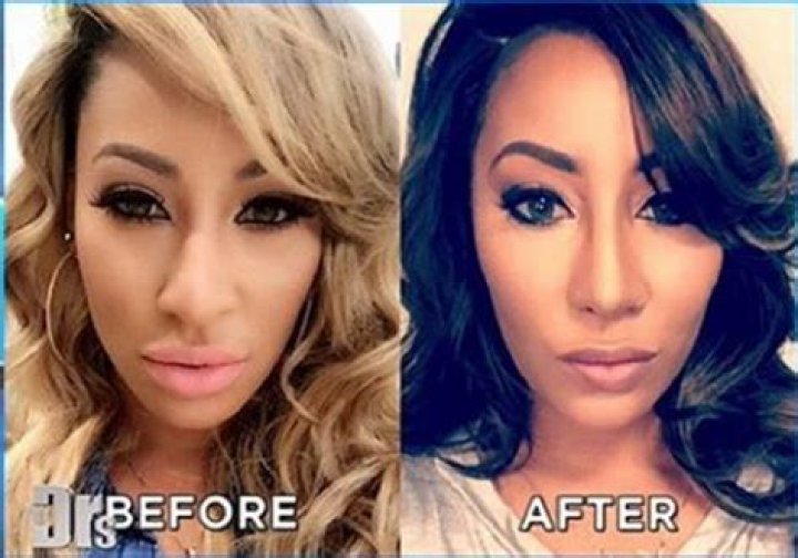 Hazel E Before Surgery Pics Nose Job Details Age Husband
