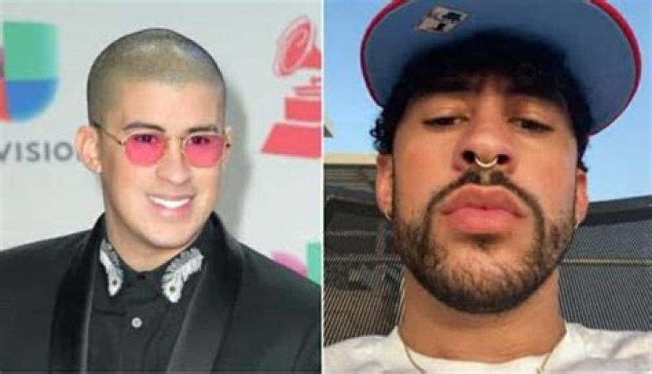 How Did Bad Bunny Transform His Jawline? BodeeNews