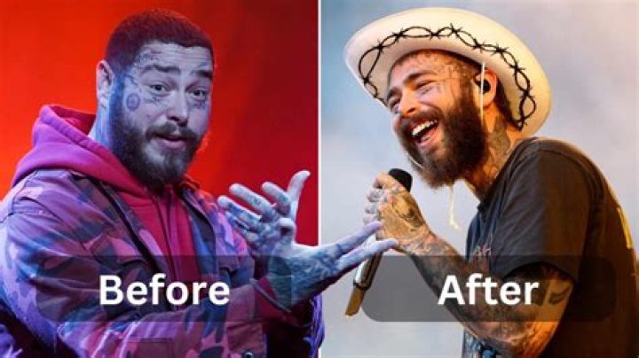 How Post Malone Went From SoundCloud to Stadium Status Complex