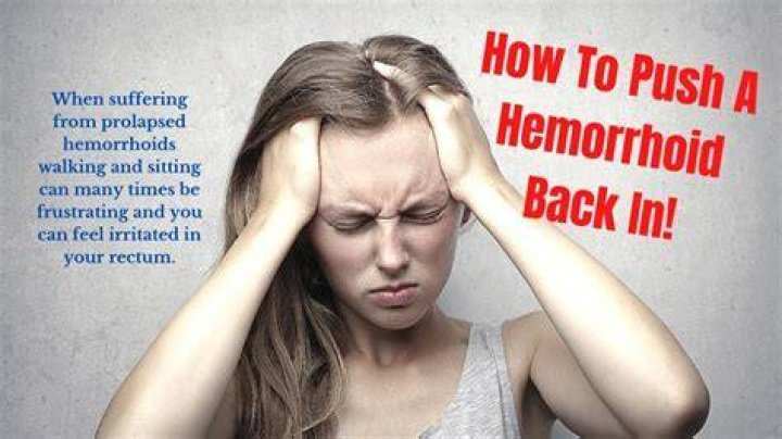 How To Push a Hemorrhoid Back In YouTube
