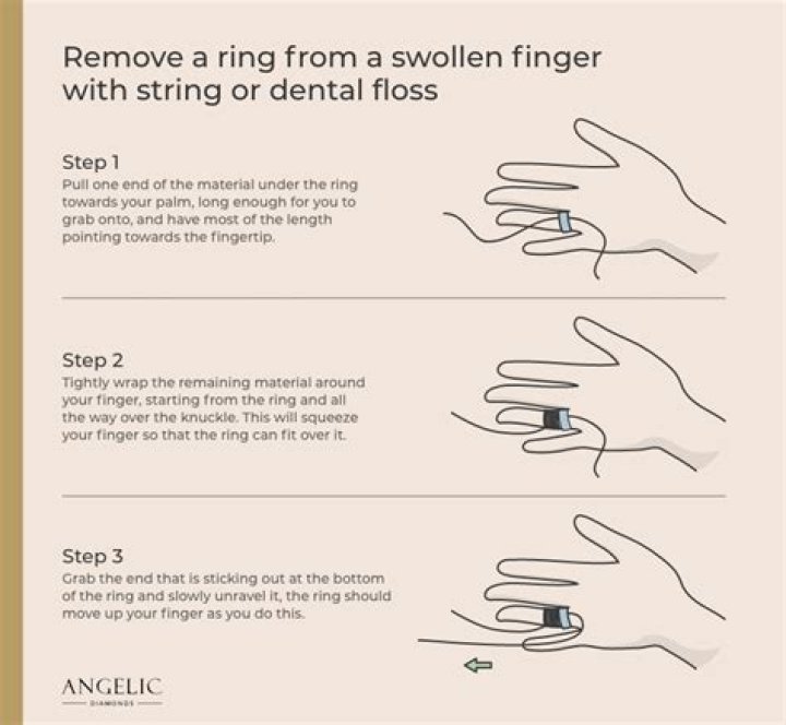 HOW TO REMOVE YOUR FINGER MAGIC TRICK YouTube