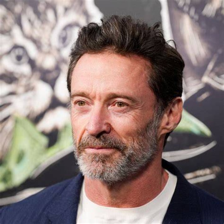 Hugh Jackman&rsquo;s Hair Is Quite The Mystery Celebrities hair transplants
