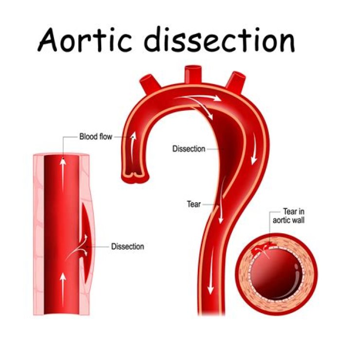Indepth Dissection of How Creators Design Plastic Models