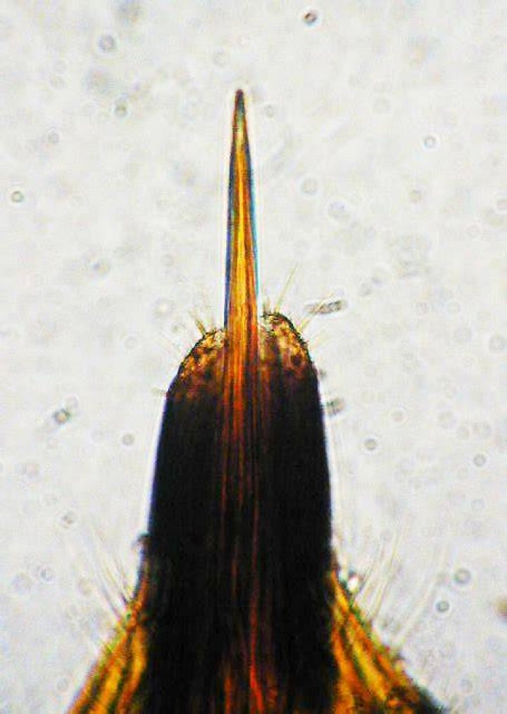 INDOOR ENTOMODERMATOSES TYPICAL LESIONS Perprin S.r.l. All rights