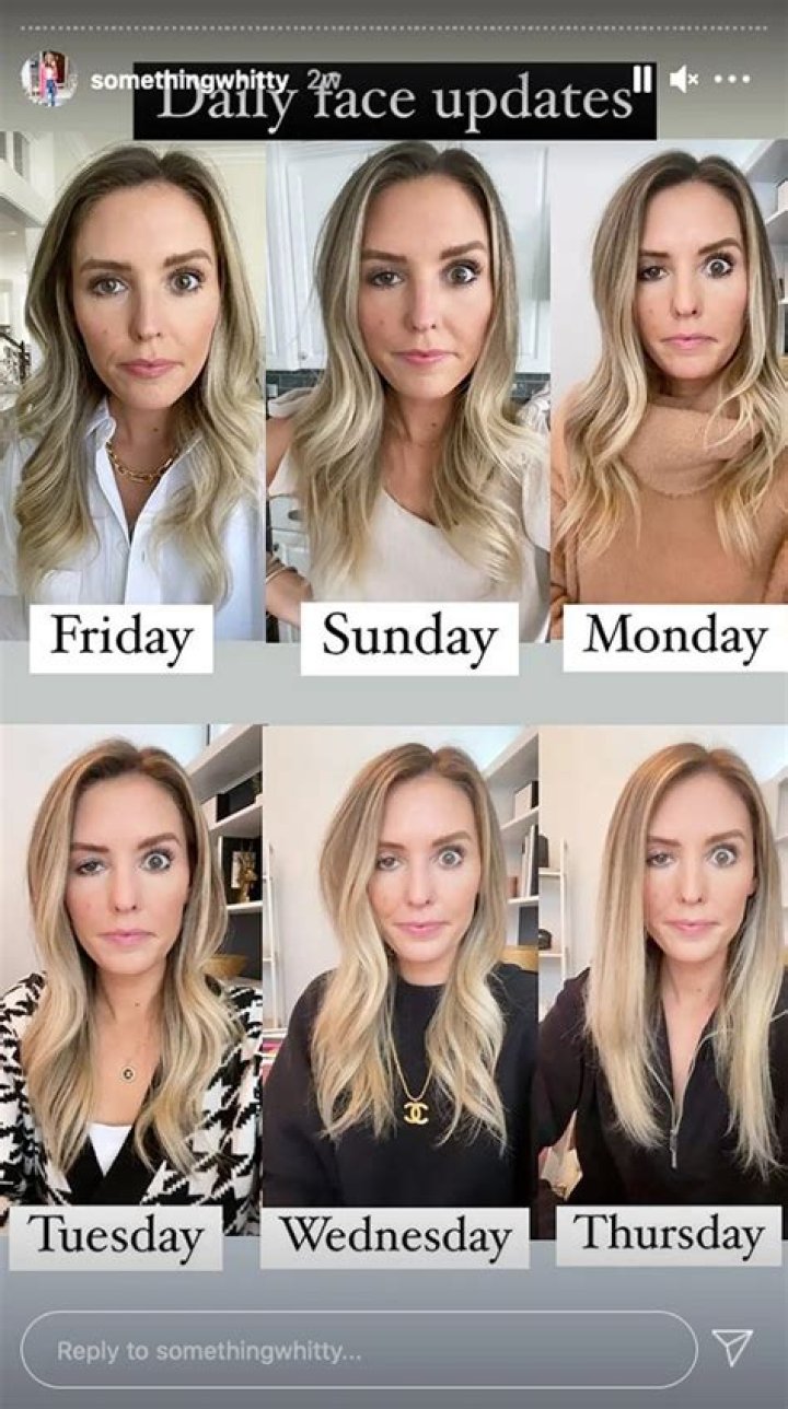 Influencer Whitney Buha Candidly Reveals What Happens When Botox Goes