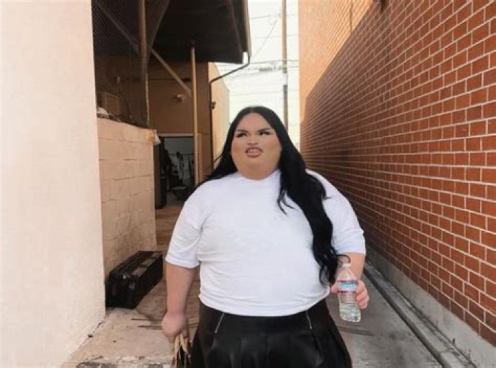 Is Al Weezy Trans? Before & After Pictures Examined!