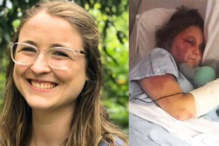 Is Kirra Hart Alive After Recent Brutal Assault?