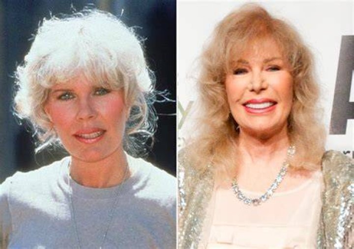 Is Loretta Swit Still Alive or Dead? What Happened to Loretta Swit? News