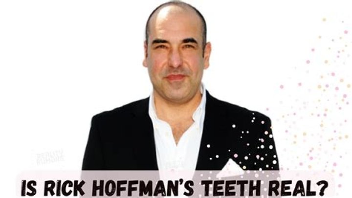 Is Rick Hoffman&rsquo;s Teeth Real? Know the Truth Behind the Suits Cast&rsquo;s Tooth!