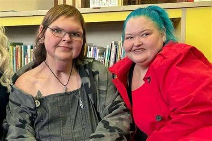 Is Tammy Slaton' Forehead Abnormal? Medical Condition Explained! Did