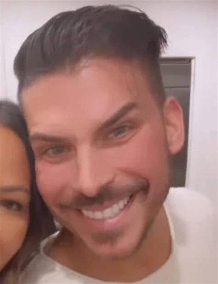 Jax Taylor Gets Botox in His Jaw Helps Teeth Grinding The Daily Dish