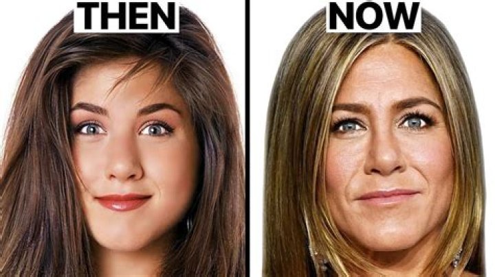 Jennifer Aniston Before and after a Nose Job Celebrity plastic