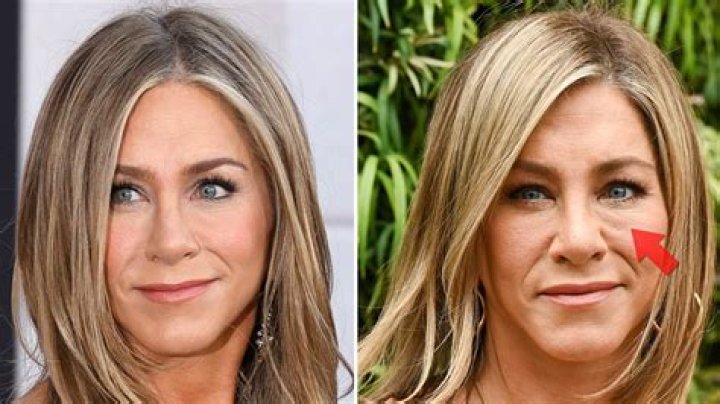 Jennifer Aniston Plastic Surgery Nose Job, Boob Job, Botox