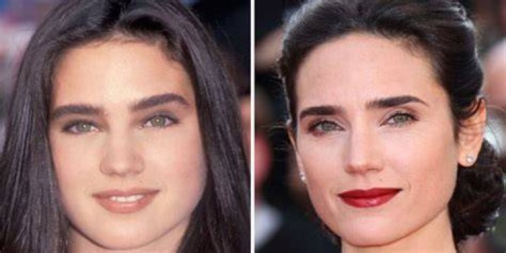 Jennifer Connelly Breast Reduction Plastic Surgery Before and After