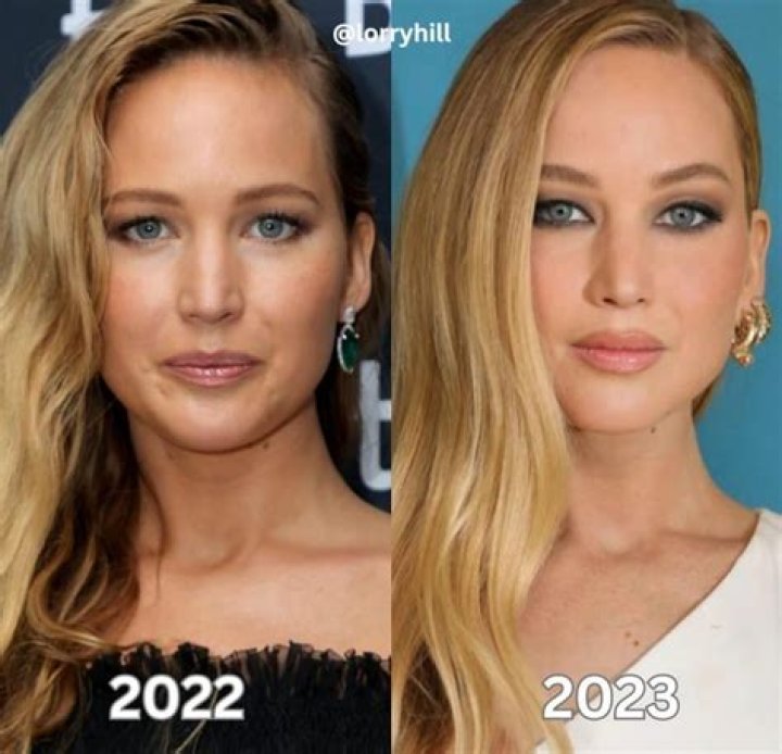 Jennifer Lawrence Before & After Plastic Surgery Makeover Exposed