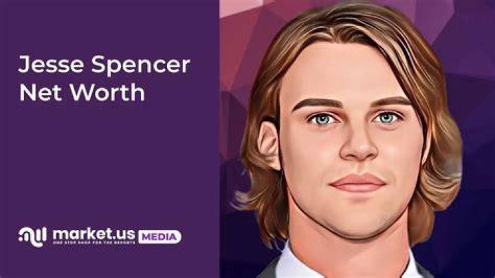 Jesse Spencer Net Worth (2020 Update)