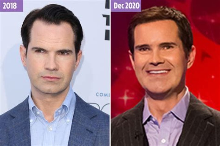 Jimmy Carr reveals dramatic transformation after getting hair