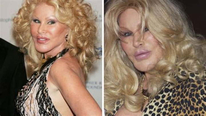 Jocelyn Wildenstein, la donna gatto dopo anni di chiurugia le foto