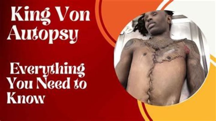 Jordan Neely Autopsy Report Cause Of Death And Family 247 News Around