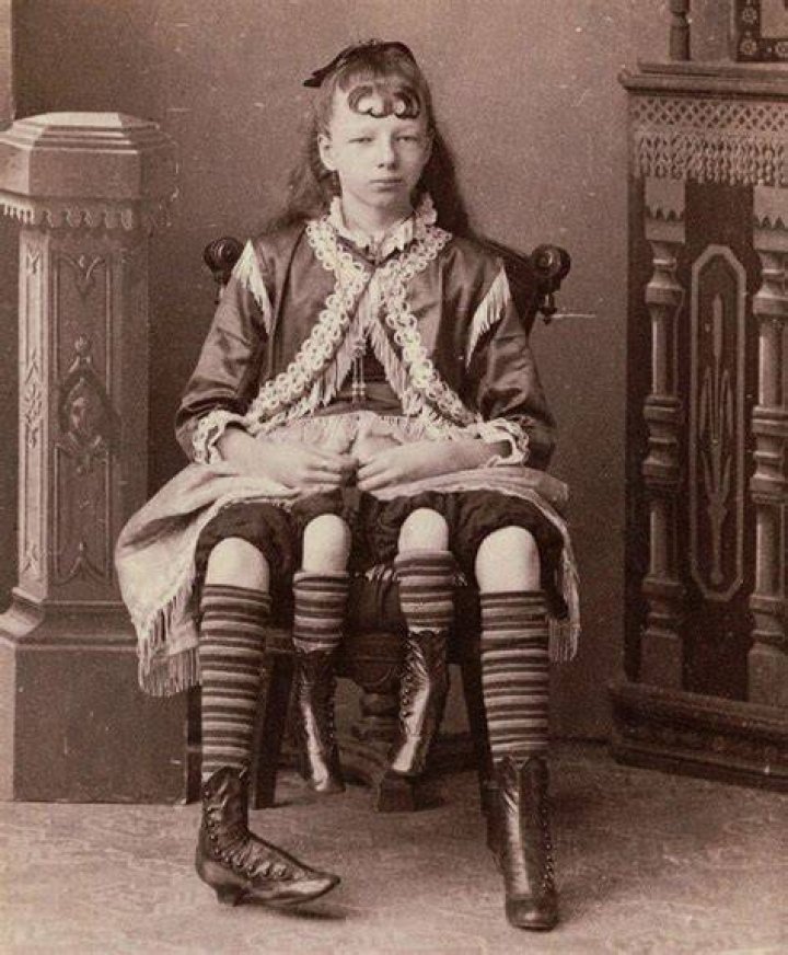 Josephine Myrtle Corbin / Josephene, la mujer de 4 piernas. Esfera
