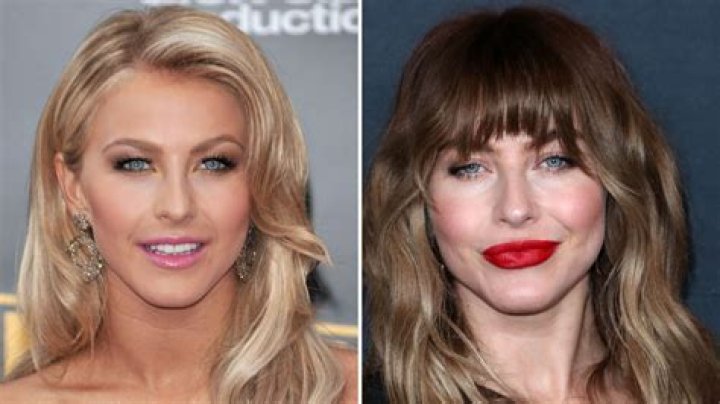 Julianne Hough Nose Job Before And After Photos