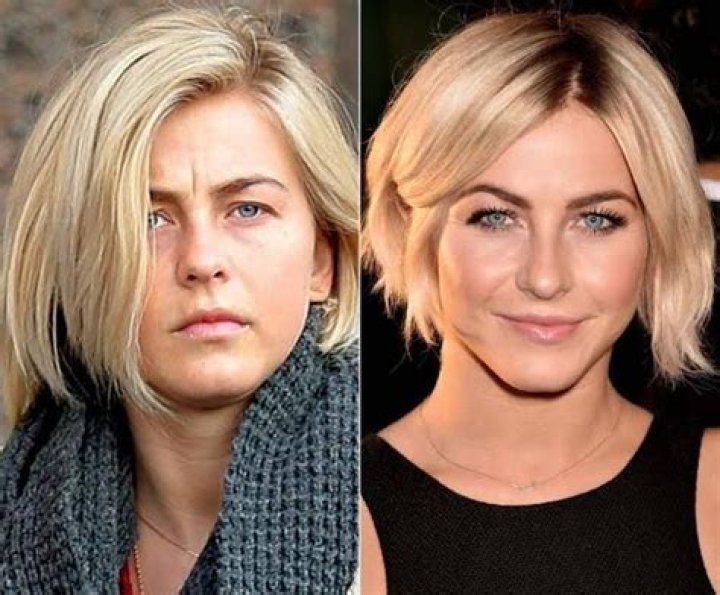 Julianne Hough Plastic Surgery Before and After